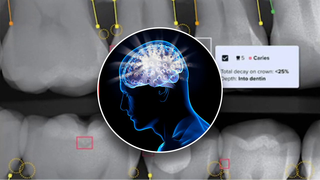 AI in Dentistry Under Fire: Expert Questions Tech's Push for Expensive Treatments Expert Skepticism Challenges AI Diagnosis official image