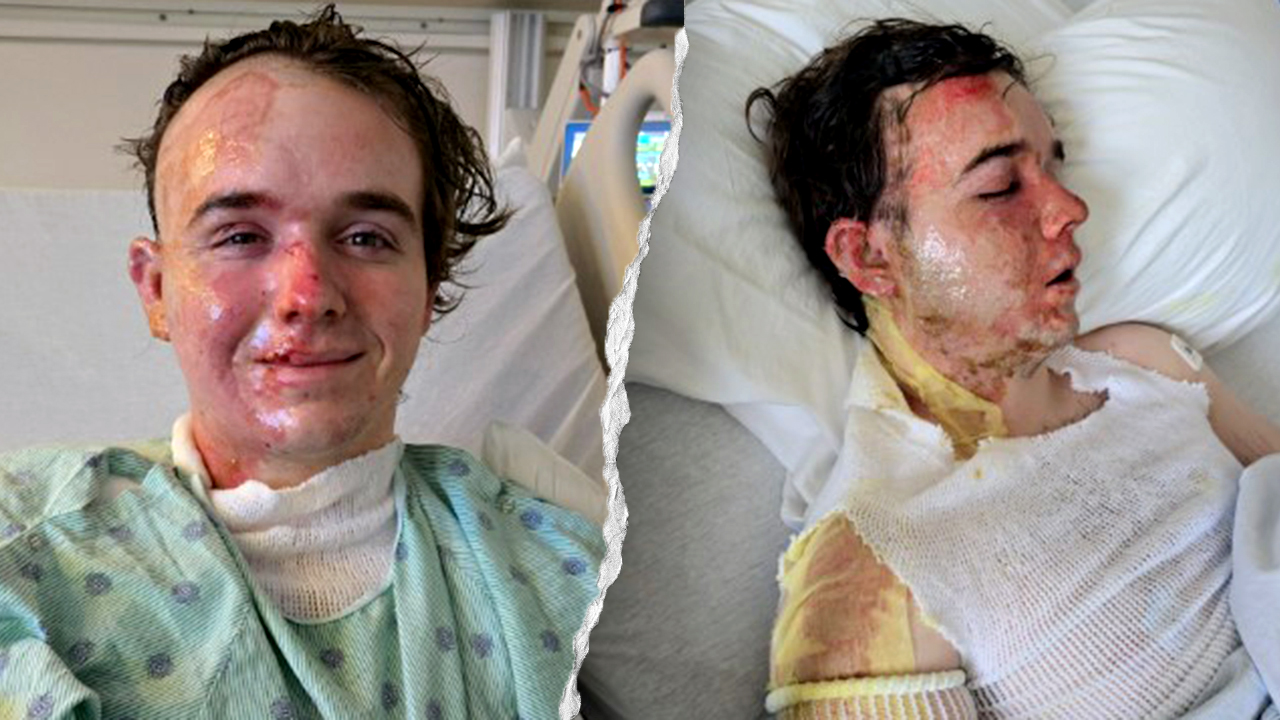 McDonald's worker allegedly doused with hot cookin